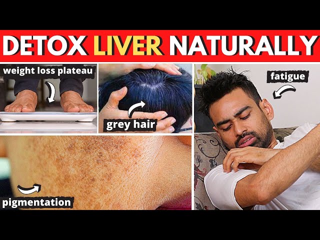 How to Clean Your Liver Naturally